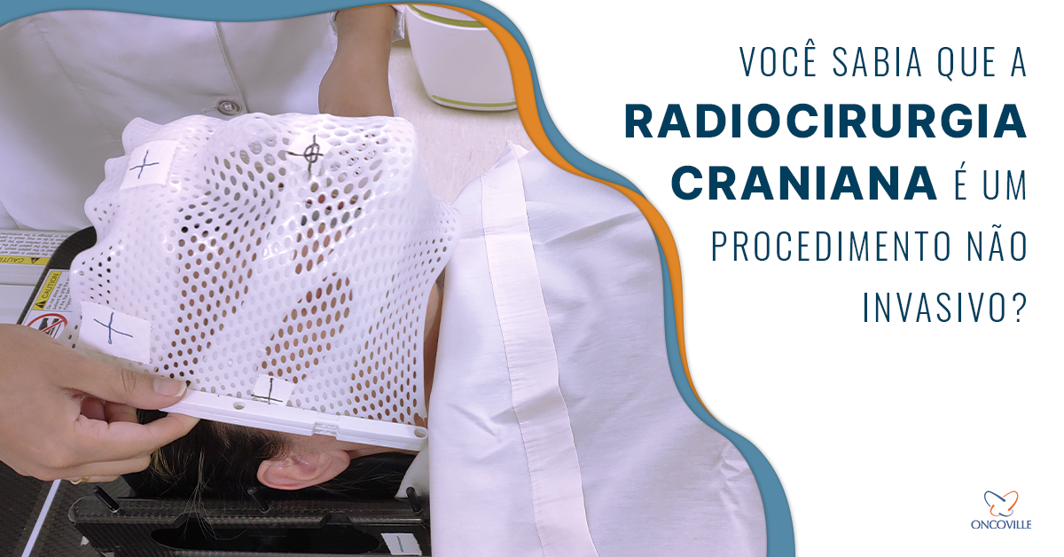 Radiocirurgia craniana