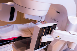 Radiocirurgia Extracraniana (SBRT)